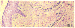 tb101.gif (13180 bytes)