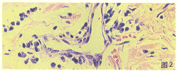 tb102.gif (13001 bytes)