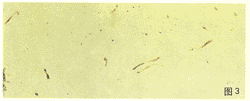 tb103.gif (9623 bytes)