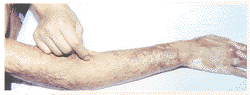 tb106.gif (7969 bytes)