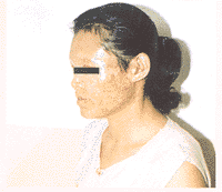 tb109.gif (8724 bytes)