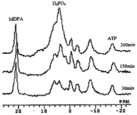 07.gif (4810 bytes)